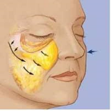 ir.azroy.sorat.bemareo.tashkhes.bede.d