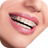 real.braces.camera.photo.editor