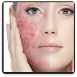 com.pishtaz_ht.darmanejoshvalaksorat