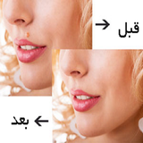 ir.bardashtane.khale.goshte.d