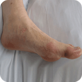 com.StatesApps.RemediesFootGout