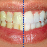 com.shirkohy.iranapple.dandansefid