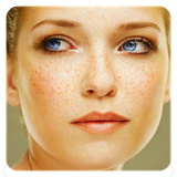 com.Get.Rid.Of.Freckles