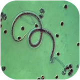 golestan.bimarihayangali