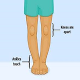 ir.darmane.pahae.paranteze.d