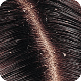 com.StatesApps.DandruffHomeRemedy