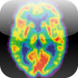 mdtoolkit.radiologycorenuclearmedicine