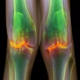 com.txtApi24novinsoft99.artroz