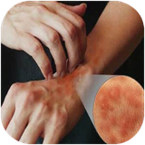 shafagh.bimarihayeposti