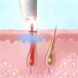 com.shirkohy.iranapple.zaeed