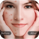 com.taptarin.treatacne