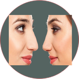 com.khorshid_ht.binikochak