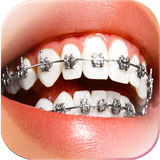 com.braces.selfie.camera.photo.editor_sticker