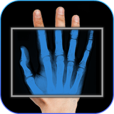 com.xray.body.scannerprank