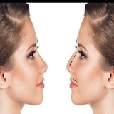 com.htmlApi24novinsoft99.binikochak