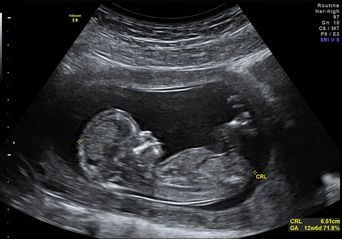 ضعف‌های امنیتی در سیستم‌های بیمارستانی